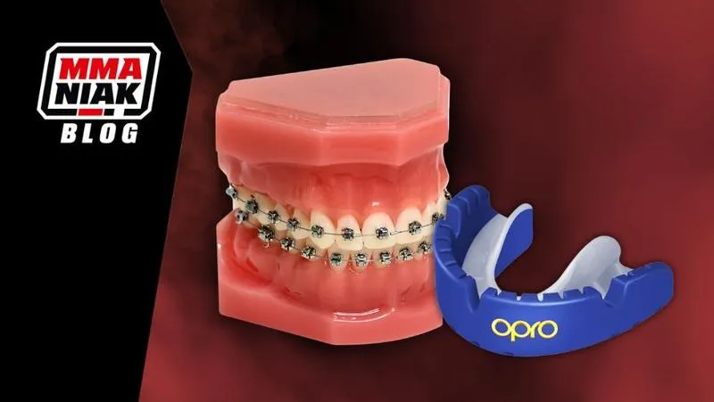 Porównanie cen aparatów ortodontycznych